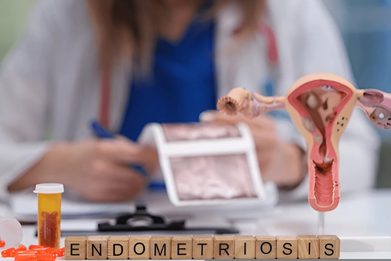 Endometriosis Treatment