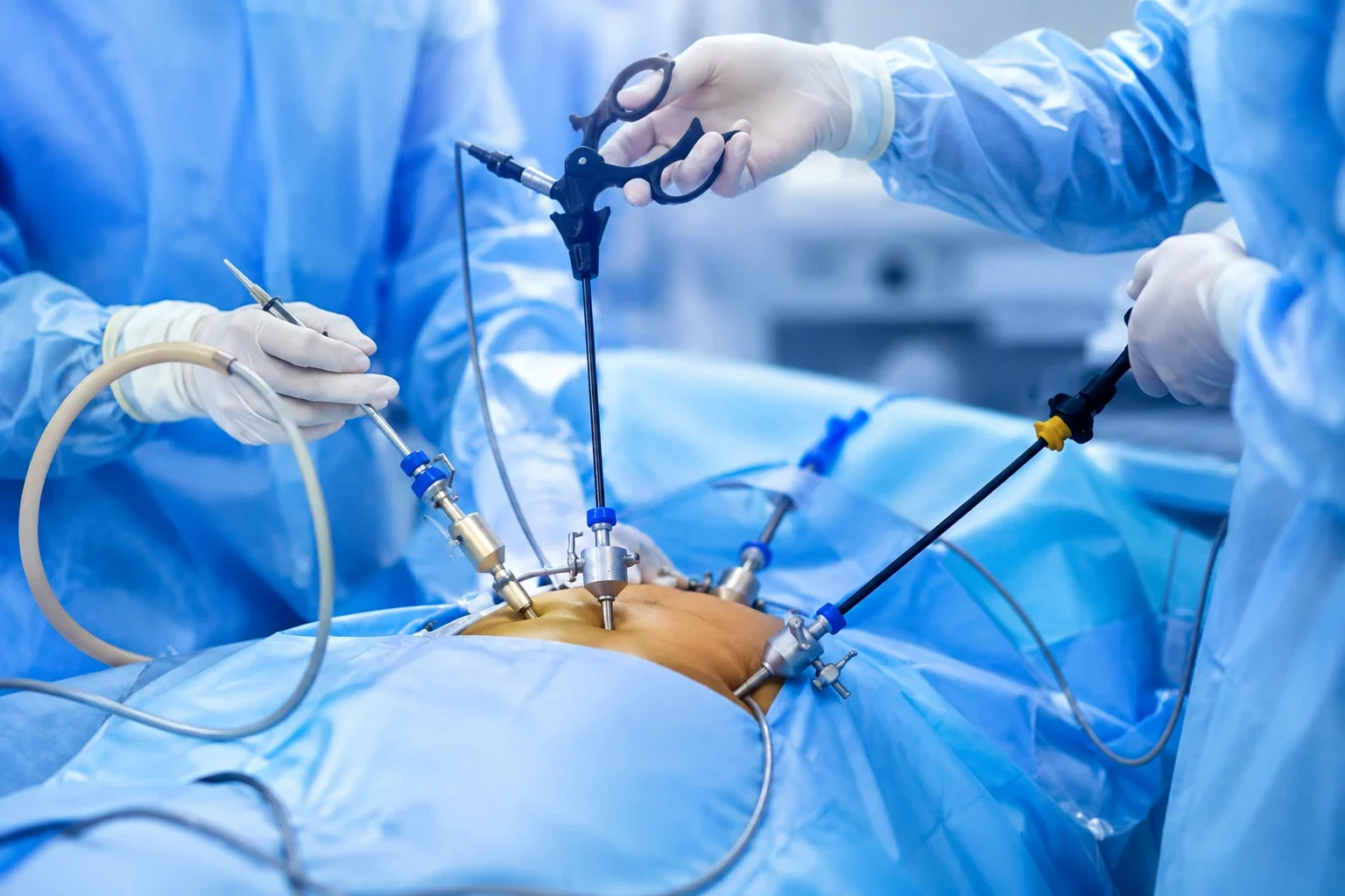 Best Laparoscopic Surgeon in Kolkata